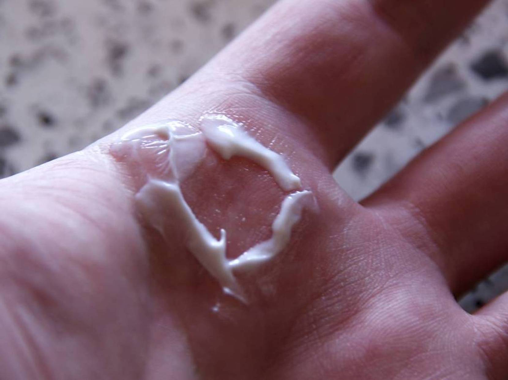 Sekundenkleber Von Den Handen Entfernen