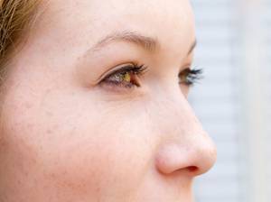 helle haut mit sommersprossen