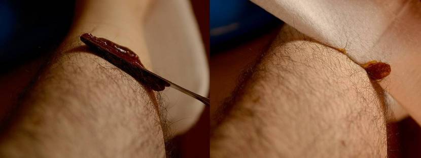 sugaring-selber-machen-anwendung